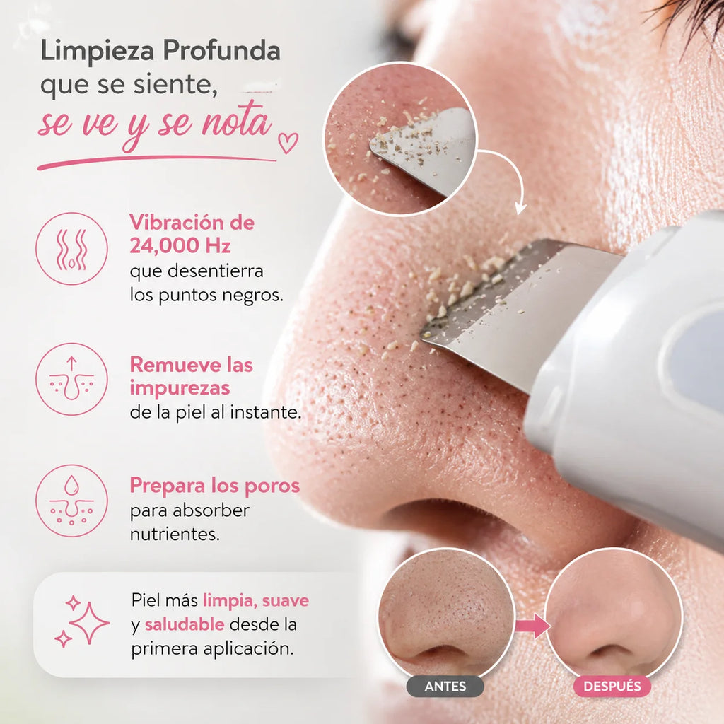 Espátula Ultrasónica Facial 3 en 1